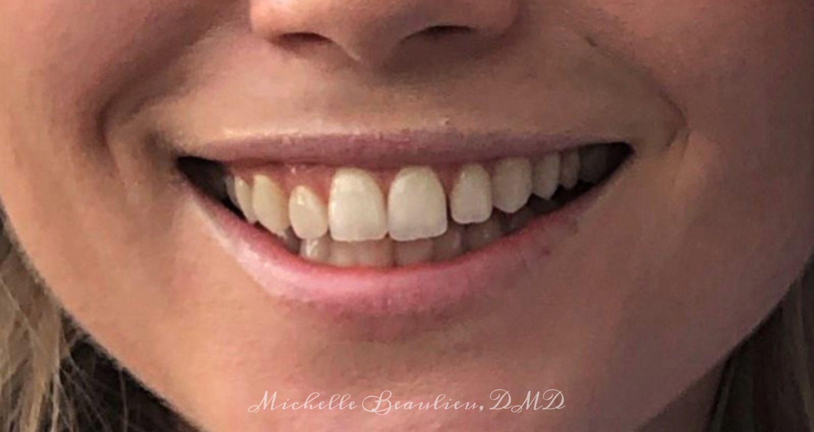 Dr Beaulieu's Work Brightwork Dental Care